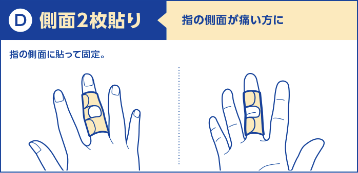 d)側面2枚貼り：指の側面が痛い方に。指の側面に貼って固定。