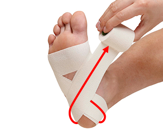 炎 腱 テーピング 足 底 膜 足底筋膜炎の治療について。痛みとの付き合い方と正しい治し方