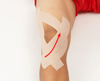 腱 テーピング 膝蓋 炎 膝蓋靭帯炎（ジャンパー膝）の治療やリハビリ、テーピングのやり方