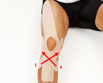 膝 ひざ 成長期の膝 ひざ の痛み予防 テーピング 巻き方 バトルウィン