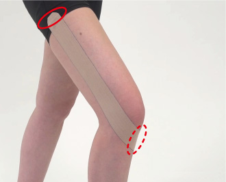 膝 ひざ 膝 ひざ の外側痛み予防 ランナーズニー 補強のキネシオロジーテーピング テーピング 巻き方 バトルウィン