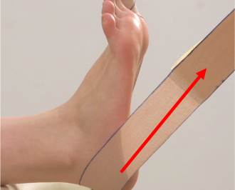 足の指 外反母趾の対策 テーピング 巻き方 バトルウィン