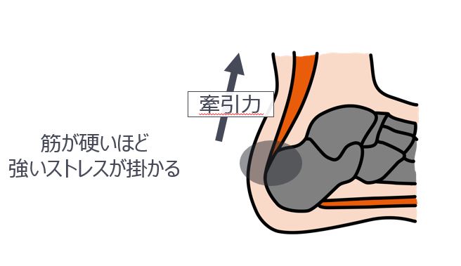 筋が固いほど強いストレスが掛かる