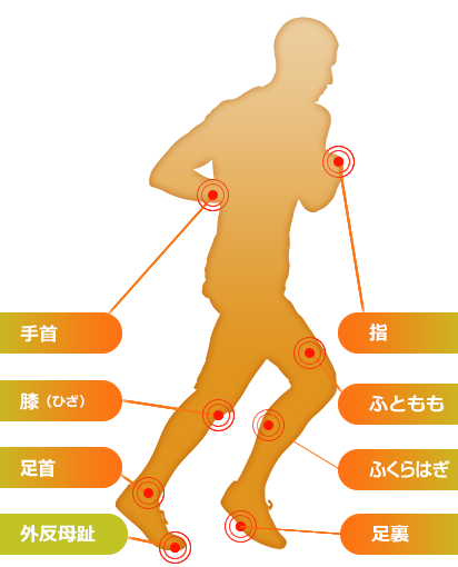 外反母趾